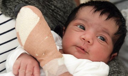 護士剪臍帶誤剪嬰兒手指 女嬰被緊急送醫接斷指