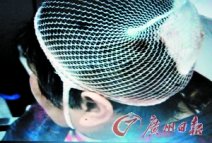 男子因心太煩砍人 男子持斧砍傷4路人一對情侶上街