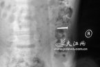 留守兒童吞硬幣留父母 江西7歲留守兒童吞硬幣阻止