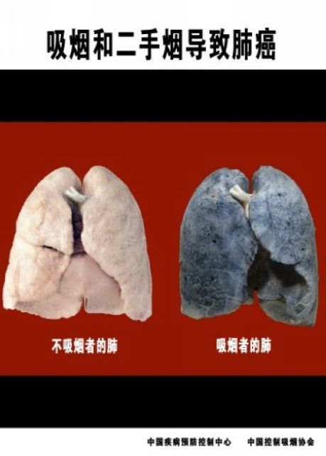 2013年世界無煙日