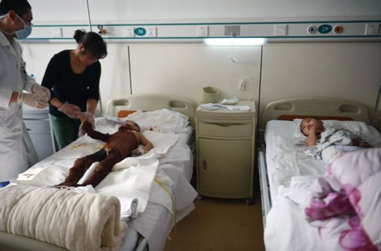 男童模仿灰太狼烤羊，把兩玩伴綁在樹上燒成重傷。