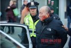 84歲老人頭上被紐約警察打出血 美國人都是這么對(duì)老