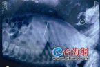 5厘米長的繡花針扎入體內(nèi) 1歲嬰兒被針扎入胸腔