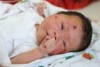 孕婦被撞胎兒生還 腹中胎兒被撞出奇跡生還