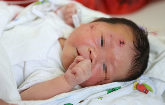 孕婦被撞胎兒生還 腹中胎兒被撞出奇跡生還