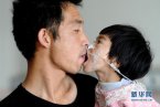 患病女兒無法進食 父親嘴對嘴喂食女兒