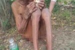 九旬老太雙目失眠 無人照顧腳上長蛆