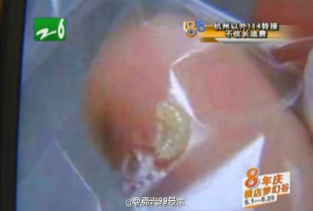 杭州姑娘手臂上寄生了皮膚蠅幼蟲
