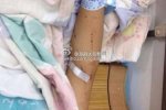 蒼南一中學(xué)女生拿剪刀捅傷2名同學(xué)