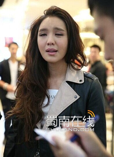 官恩娜得貝爾氏麻痹癥 出現(xiàn)面癱表情僵硬