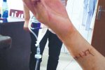 拒陪室友聊天被劃傷5刀 平昌二中發(fā)生校園暴力