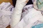蒼南龍港第九中學湖前中學女生用剪刀捅傷兩同學