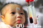 嬰兒血液乳白色檢測(cè)不出任何數(shù)據(jù)  罕見病全國(guó)只有