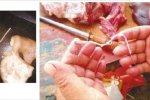 豬肉有鉤蟲(chóng)是真的嗎 不是鉤蟲(chóng)是血管和筋