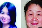 獲得性皮膚松弛癥 28歲女子胡娟分娩后一夜變老太
