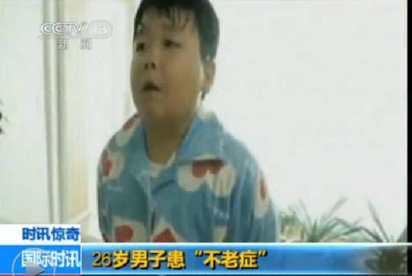 男子患不老癥