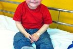 5歲男孩嚴重過敏 英國男孩出生4個月開始過敏