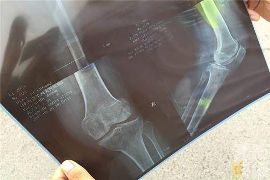 出租司機(jī)撞倒老太送醫(yī)途中將老太趕下車