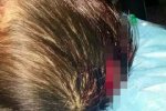 邵東虐童事件 10.11湖南邵陽惡性虐童案最新消息