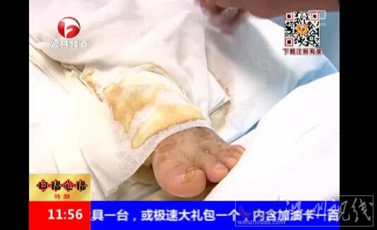 女子救女童遭狗瘋狂撕咬