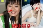 孫儷自曝整過容 孫儷做客《非常靜距離》自曝整過容