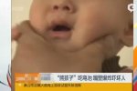 小孩嗑舊電池嘴被炸開一個窟窿