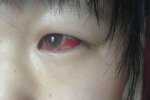 吉林學生集體中毒 大安市新艾里鄉中學回應