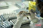 艾滋病有望治愈 新療法有望徹底治愈