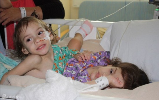 姐妹共用三條腿