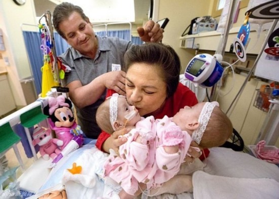 姐妹共用三條腿