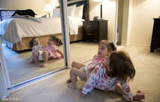 姐妹共用三條腿