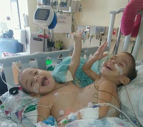 姐妹共用三條腿