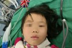 玩飛鏢扎妹妹眉心 所幸未傷到顱內