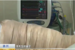 點蚊香引燃父親 是意外事故