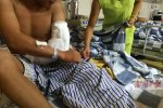 因多看一眼被追砍 小伙被砍傷住院