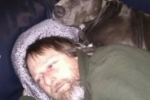 被愛犬舔舐后截肢 是截掉四肢啊