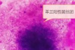 摸文物后住院7次 想想很嚇人哦