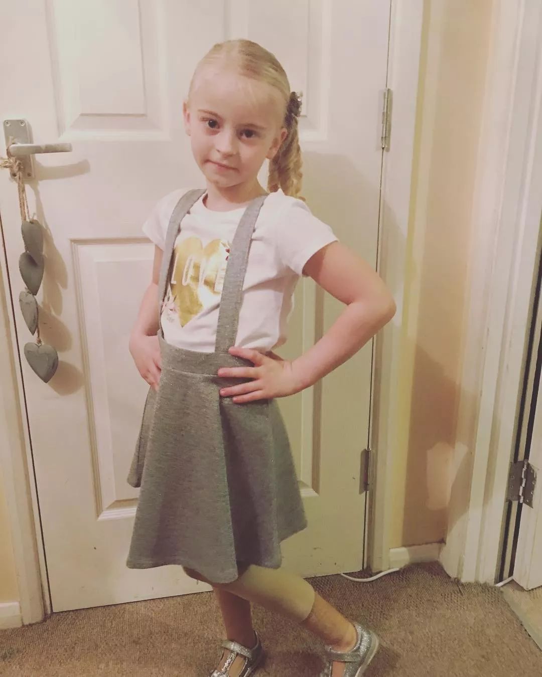 截肢仙女紅遍全球