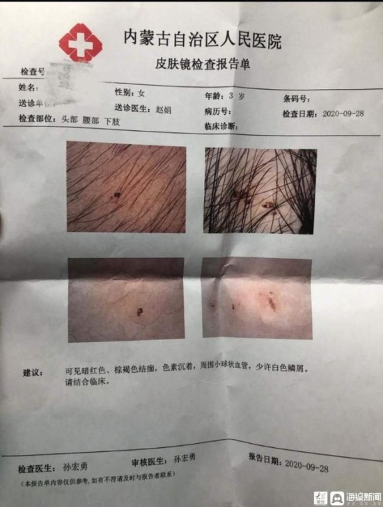 被針扎幼兒家長再發(fā)聲 呼和浩特鼎奇幼兒園虐待事件