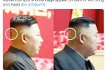金正恩后腦的繃帶和斑點增加了對他的健康猜測
