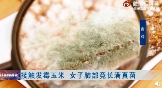 女子接觸霉變玉米后肺部長(zhǎng)滿真菌