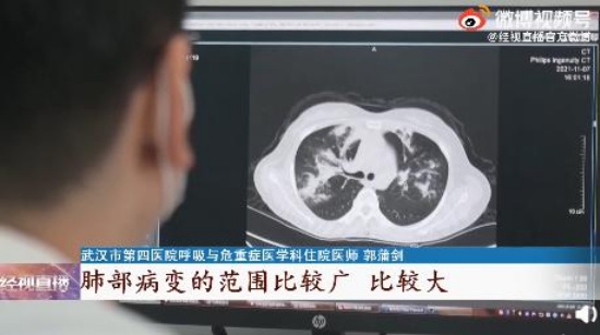 女子接觸霉變玉米后肺部長(zhǎng)滿真菌